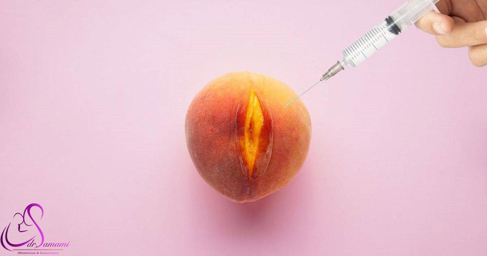 تزریق ژل به واژن