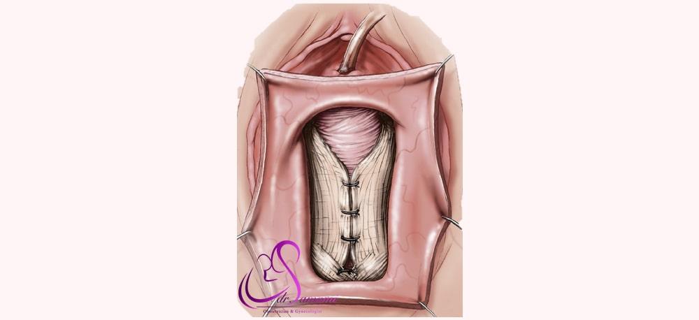 جراحی ترمیمی (Constructive)