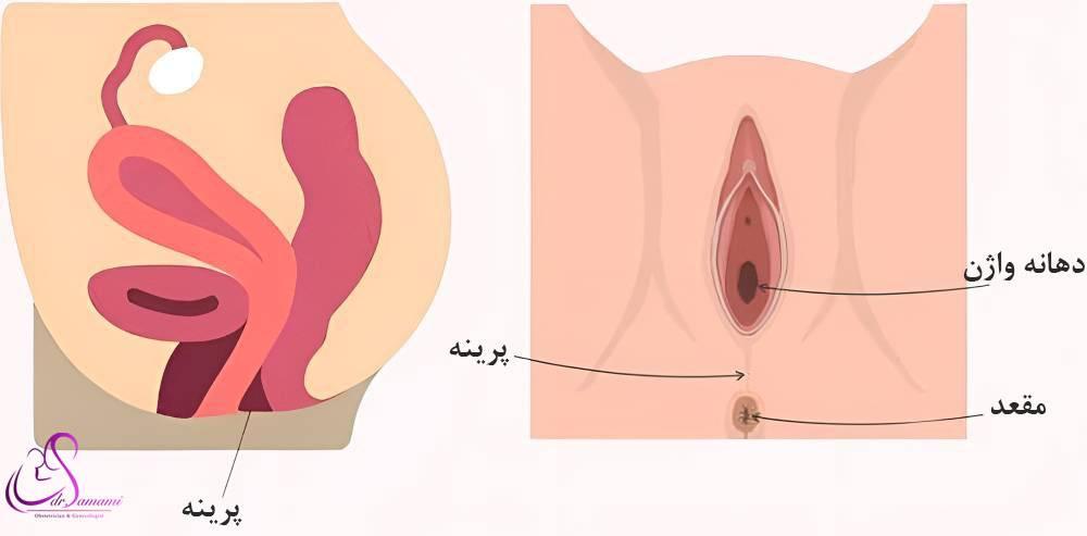 پرینورافی چیست