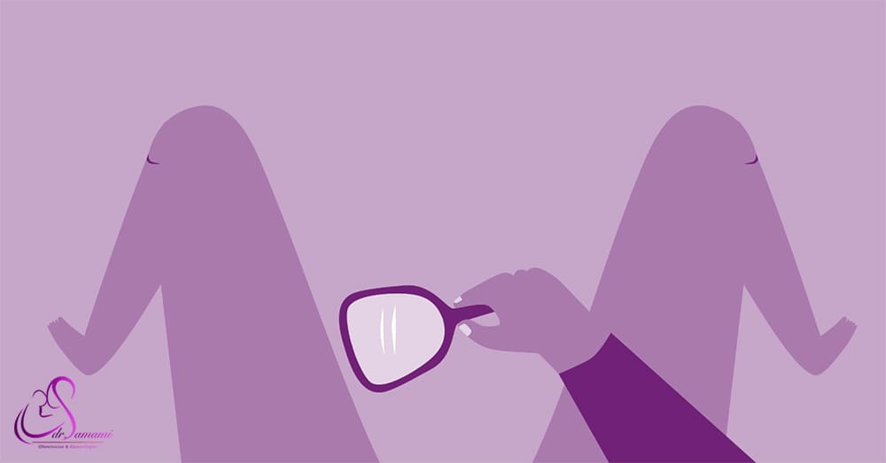 محل زگیل تناسلی