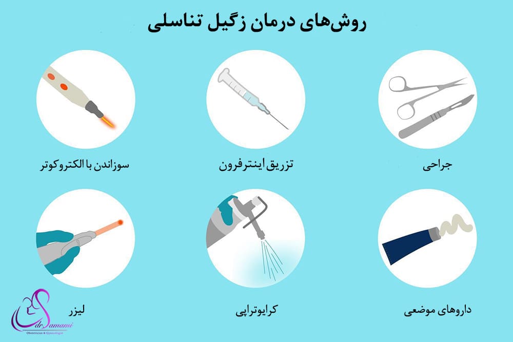 درمان زگیل تناسلی