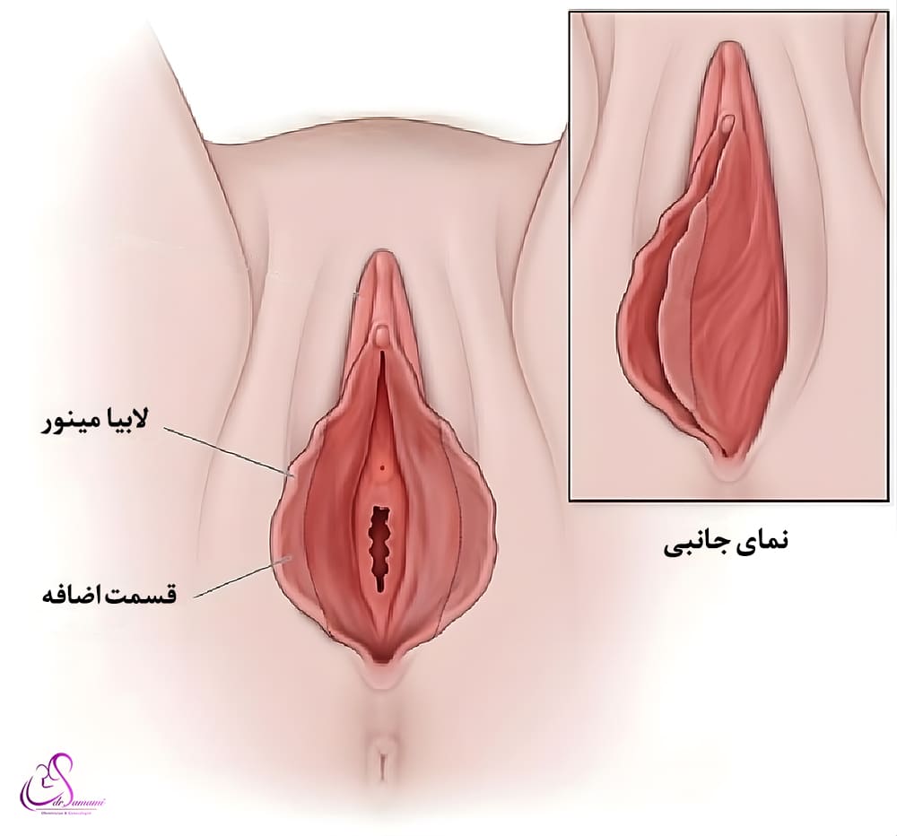 چه چیزی باعث بزرگ شدن واژن می‌شود؟