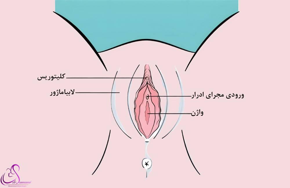 عکس لابیاماژور