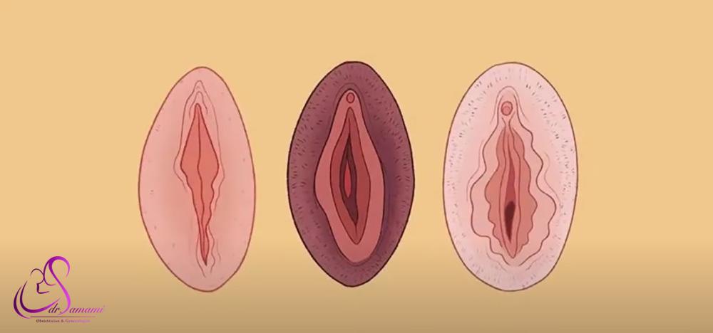 تغییرات واژن بعد از زایمان طبیعی