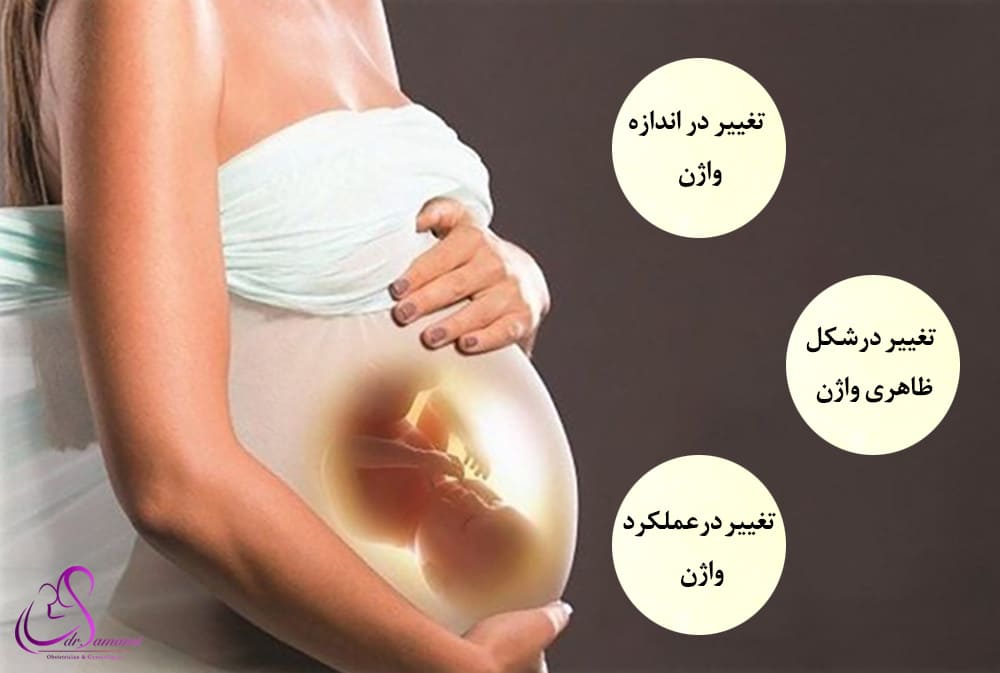 شکل واژن بعد از زایمان