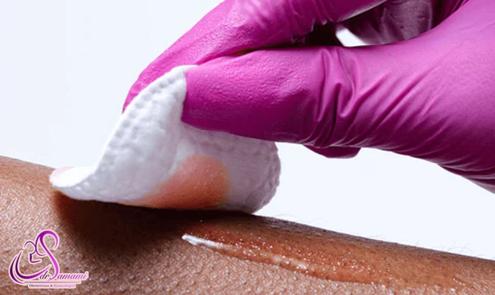 پیلینگ شیمیایی با اسیدهای میوه