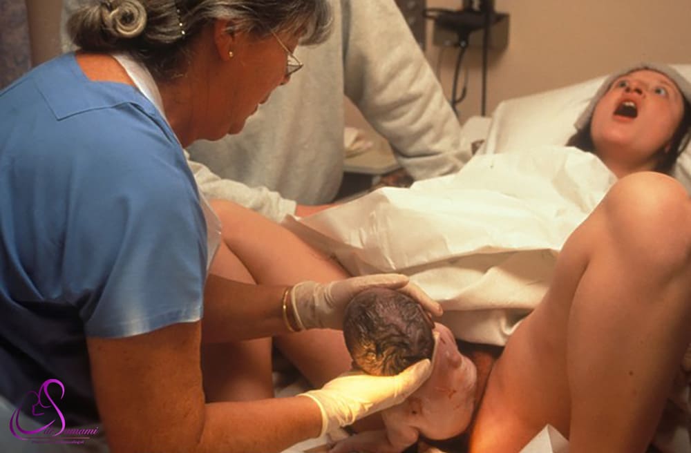 فشار زیاد به واژن هنگام زایمان