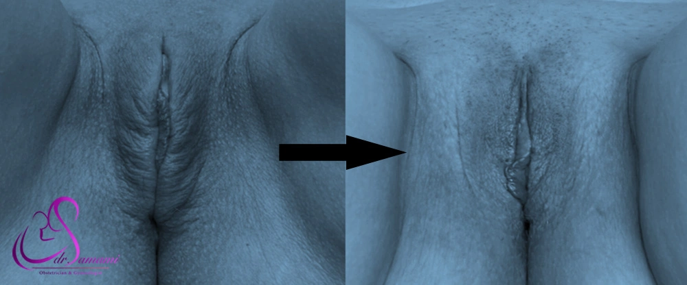 تغییرات ظاهری