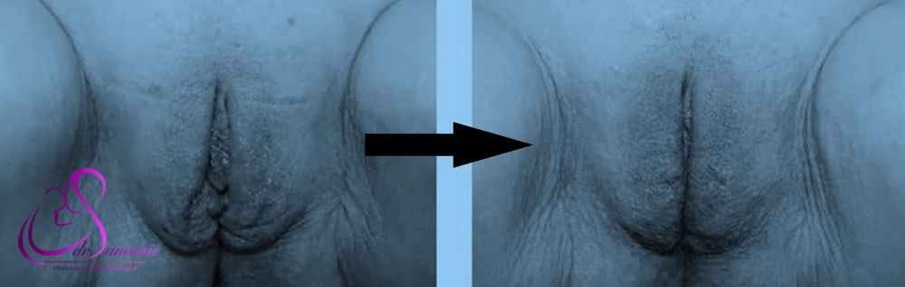 عمل ليفت لابيا